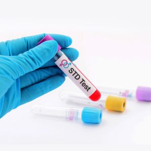 STD Basic Screening